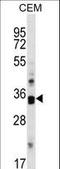 Cyclin Dependent Kinase 10 antibody, LS-C164324, Lifespan Biosciences, Western Blot image 