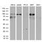 ERCC Excision Repair 3, TFIIH Core Complex Helicase Subunit antibody, CF809371, Origene, Western Blot image 
