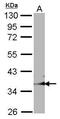 GULP PTB Domain Containing Engulfment Adaptor 1 antibody, PA5-21865, Invitrogen Antibodies, Western Blot image 