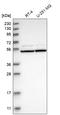 RAD23 Homolog A, Nucleotide Excision Repair Protein antibody, HPA026418, Atlas Antibodies, Western Blot image 