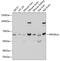 Serine/threonine-protein phosphatase 2A 65 kDa regulatory subunit A alpha isoform antibody, GTX33425, GeneTex, Western Blot image 