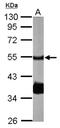 Protein Phosphatase 2 Regulatory Subunit Bbeta antibody, NBP1-33043, Novus Biologicals, Western Blot image 