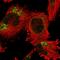 Ankyrin Repeat Domain 44 antibody, HPA056549, Atlas Antibodies, Immunofluorescence image 