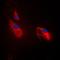 Phosphofructokinase, Platelet antibody, orb214385, Biorbyt, Immunofluorescence image 