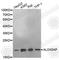 Arachidonate 5-Lipoxygenase Activating Protein antibody, A2620, ABclonal Technology, Western Blot image 