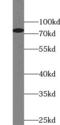 Probable ATP-dependent RNA helicase DHX58 antibody, FNab04763, FineTest, Western Blot image 
