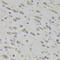 60S ribosomal protein L3 antibody, LS-C749075, Lifespan Biosciences, Immunohistochemistry paraffin image 