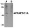 Phospholipid Phosphatase 4 antibody, A14264, Boster Biological Technology, Western Blot image 