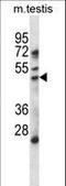 Histone Deacetylase 11 antibody, LS-C166820, Lifespan Biosciences, Western Blot image 