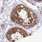 Cell Death Inducing P53 Target 1 antibody, HPA049352, Atlas Antibodies, Immunohistochemistry paraffin image 