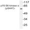 Ribosomal Protein S6 Kinase B1 antibody, AP20854PU-N, Origene, Western Blot image 