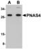 PPPDE peptidase domain-containing protein 1 antibody, MBS150332, MyBioSource, Western Blot image 