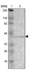 Zinc Finger Protein 222 antibody, PA5-52047, Invitrogen Antibodies, Western Blot image 