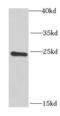 RAB17, Member RAS Oncogene Family antibody, FNab06997, FineTest, Western Blot image 