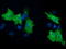 Phosphoinositide-3-Kinase Adaptor Protein 1 antibody, TA501722, Origene, Immunofluorescence image 