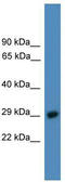 Proteasome 26S Subunit, Non-ATPase 9 antibody, TA342582, Origene, Western Blot image 