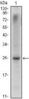 Homeobox protein Nkx-3.1 antibody, AM06425SU-N, Origene, Western Blot image 