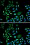 CDKN2A antibody, orb129709, Biorbyt, Immunofluorescence image 