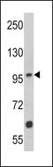 Muscle Associated Receptor Tyrosine Kinase antibody, MBS9204388, MyBioSource, Western Blot image 