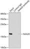 N(Alpha)-Acetyltransferase 20, NatB Catalytic Subunit antibody, 22-702, ProSci, Immunoprecipitation image 