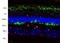 S-Antigen Visual Arrestin antibody, NBP2-25161, Novus Biologicals, Immunofluorescence image 