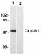 C-X3-C Motif Chemokine Receptor 1 antibody, AHP1589, Bio-Rad (formerly AbD Serotec) , Western Blot image 
