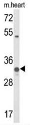 Coenzyme Q5, Methyltransferase antibody, AP51026PU-N, Origene, Western Blot image 