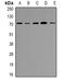 Pro-neuregulin-1, membrane-bound isoform antibody, orb382713, Biorbyt, Western Blot image 