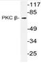Protein kinase C beta type antibody, AP20795PU-N, Origene, Western Blot image 