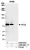 Aconitase antibody, A305-302A, Bethyl Labs, Immunoprecipitation image 