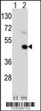 MAGE Family Member A9B antibody, 62-155, ProSci, Western Blot image 