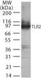 Toll Like Receptor 2 antibody, TA336461, Origene, Western Blot image 