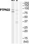 Protein Tyrosine Phosphatase Non-Receptor Type 22 antibody, TA315315, Origene, Western Blot image 
