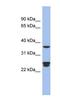 Ornithine Decarboxylase Antizyme 2 antibody, NBP1-70661, Novus Biologicals, Western Blot image 