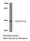 Vasodilator Stimulated Phosphoprotein antibody, LS-C177638, Lifespan Biosciences, Western Blot image 
