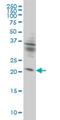 Kinesin Family Member 26A antibody, H00026153-M01, Novus Biologicals, Western Blot image 