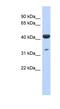 CDP-L-Ribitol Pyrophosphorylase A antibody, NBP1-79722, Novus Biologicals, Western Blot image 