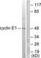 Cyclin E1 antibody, TA311853, Origene, Western Blot image 