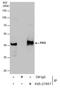 Serpin Family B Member 2 antibody, PA5-27857, Invitrogen Antibodies, Immunoprecipitation image 