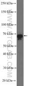 Guanylate Binding Protein 2 antibody, 11854-1-AP, Proteintech Group, Western Blot image 