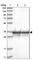 Pyrophosphatase (Inorganic) 2 antibody, HPA031671, Atlas Antibodies, Western Blot image 