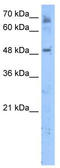 Membrane Bound O-Acyltransferase Domain Containing 7 antibody, TA338652, Origene, Western Blot image 