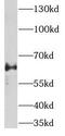 Wnt Ligand Secretion Mediator antibody, FNab03601, FineTest, Western Blot image 