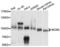 Minichromosome Maintenance Complex Component 5 antibody, LS-C334137, Lifespan Biosciences, Western Blot image 