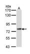 Adseverin antibody, PA5-22243, Invitrogen Antibodies, Western Blot image 