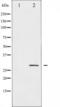 Heat Shock Protein Family B (Small) Member 1 antibody, TA325546, Origene, Western Blot image 