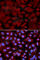 O-Linked N-Acetylglucosamine (GlcNAc) Transferase antibody, A1990, ABclonal Technology, Immunofluorescence image 