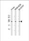 5',3'-Nucleotidase, Mitochondrial antibody, PA5-49543, Invitrogen Antibodies, Western Blot image 