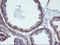 Vasodilator Stimulated Phosphoprotein antibody, LS-C172720, Lifespan Biosciences, Immunohistochemistry frozen image 
