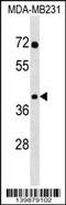 Small Nuclear RNA Activating Complex Polypeptide 3 antibody, 60-380, ProSci, Western Blot image 